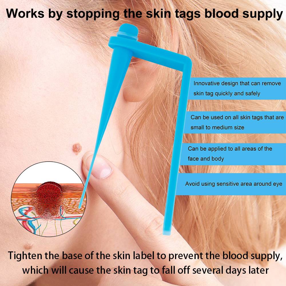 Skin Tag Remover Device Wart Treatment Skin Care Tool