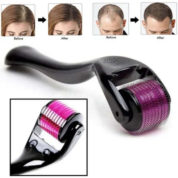 Derma Roller 0.5mm 540 Titanium Hair Skin Therapy 2025 - Easy to use