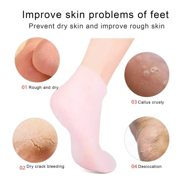 Silicone Jelly Socks Ultra-Moisturizing Gel Foot Care - Improve skin problems of feet